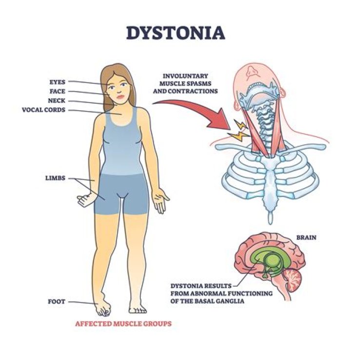 What Is Wrong With Jeff Pegues Voice? Spasmodic Dysphonia and Strain Concerning The Fans